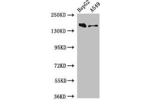 Western Blot Positive WB detected in: HepG2 whole cell lysate, A549 whole cell lysate All lanes: DOT1L antibody at 3 μg/mL Secondary Goat polyclonal to rabbit IgG at 1/50000 dilution Predicted band size: 185, 165 kDa Observed band size: 185 kDa