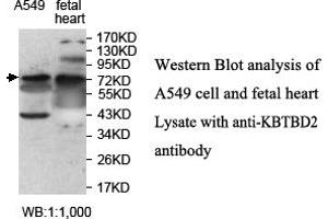 Image no. 1 for anti-Kelch Repeat and BTB (POZ) Domain Containing 2 (KBTBD2) antibody (ABIN1577433) (KBTBD2 抗体)