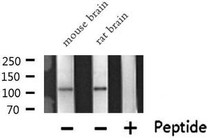 Western blot analysis of PKN1/PRK1 expression in various lysates (PKN1 抗体  (Internal Region))