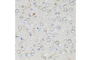 Immunohistochemistry of paraffin-embedded rat brain using BEST1 antibody (ABIN4903043) at dilution of 1:100 (40x lens). (Bestrophin 1 抗体)