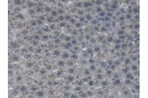 IHC-P analysis of Rat Liver Tissue, with DAB staining. (AGT 抗体)