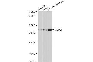 Western blot analysis of extracts of various cell lines, using LIMK2 antibody (ABIN1876597) at 1:1000 dilution. (LIMK2 抗体)