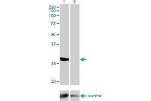 Western blot analysis of DGUOK over-expressed 293 cell line, cotransfected with DGUOK Validated Chimera RNAi (Lane 2) or non-transfected control (Lane 1). (Deoxyguanosine Kinase 抗体  (AA 1-89))