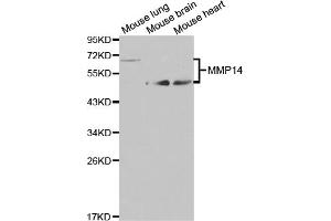 Western blot analysis of extracts of various cell lines, using MMP14 antibody (ABIN5971375) at 1/1000 dilution.