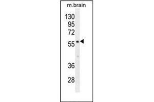Western blot analysis of PDE1B Antibody (C-term) in mouse brain tissue lysates (35ug/lane). (PDE1B 抗体  (C-Term))