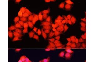 Immunofluorescence analysis of HeLa cells using ARAF Polyclonal Antibody at dilution of 1:100.