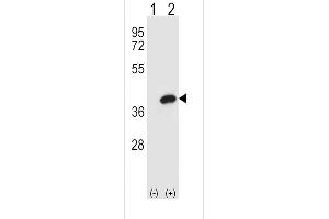Western blot analysis of AKR1B1 using rabbit polyclonal AKR1B1 Antibody using 293 cell lysates (2 ug/lane) either nontransfected (Lane 1) or transiently transfected (Lane 2) with the AKR1B1 gene. (AKR1B1 抗体  (AA 102-135))