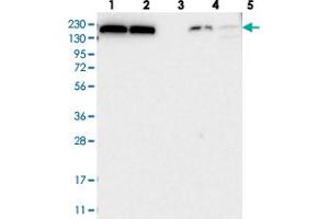 Western blot analysis of Lane 1: RT-4, Lane 2: U-251 MG, Lane 3: Human Plasma, Lane 4: Liver, Lane 5: Tonsil with KIAA1462 polyclonal antibody  at 1:250-1:500 dilution. (JCAD/KIAA1462 抗体)