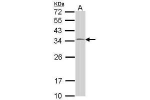 Western Blotting (WB) image for anti-HUS1 Checkpoint Homolog (S. Pombe) (HUS1) (Center) antibody (ABIN2856928)
