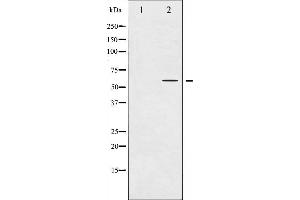 Western blot analysis of Tyrosine Hydroxylase phosphorylation expression in UV treated 293 whole cell lysates,The lane on the left is treated with the antigen-specific peptide. (Tyrosine Hydroxylase 抗体  (pSer31))