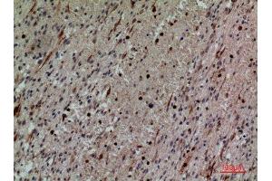 Immunohistochemistry (IHC) analysis of paraffin-embedded Human Brain, antibody was diluted at 1:100. (CD58 抗体  (Internal Region))