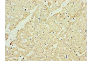 Immunohistochemistry of paraffin-embedded human heart tissue using ABIN7149107 at dilution of 1:100 (UQCRC2 抗体  (AA 224-453))