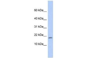 RPS15 antibody used at 1 ug/ml to detect target protein. (RPS15 抗体  (Middle Region))