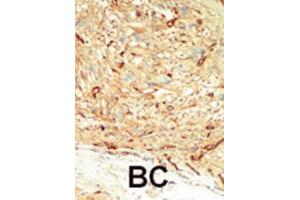Immunohistochemistry (IHC) image for anti-Macrophage Stimulating 1 (Hepatocyte Growth Factor-Like) (MST1) antibody (ABIN3003576) (MST1 抗体)