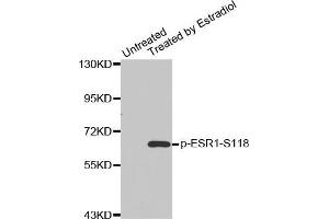 Western blot analysis of extracts from MDA cells using Phospho-ESR1-S118 antibody. (Estrogen Receptor alpha 抗体  (pSer118))