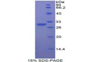 SDS-PAGE analysis of Human dNER Protein. (DNER 蛋白)