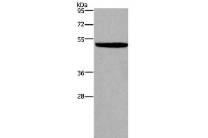 Western Blot analysis of NIH/3T3 cell using KCNN4 Polyclonal Antibody at dilution of 1:450 (KCNN4 抗体)