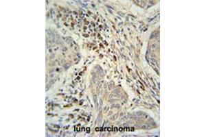 Immunohistochemistry (Paraffin-embedded Sections) (IHC (p)) image for anti-Chromosome 19 Open Reading Frame 50 (C19orf50) (AA 66-95), (Middle Region) antibody (ABIN950811)