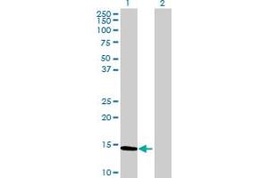 Western Blot analysis of CALCA expression in transfected 293T cell line by CALCA MaxPab polyclonal antibody. (CGRP 抗体  (AA 1-141))