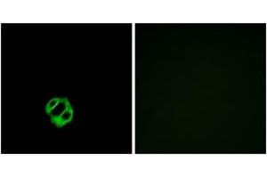 Immunofluorescence analysis of MCF7 cells, using AGTRL1 Antibody. (Apelin Receptor 抗体  (AA 141-190))
