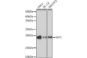 Western blot analysis of extracts of various cell lines, using SKP1 Rabbit mAb (ABIN7270120) at 1:1000 dilution. (SKP1 抗体)