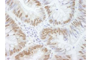 Immunohistochemistry (IHC) image for anti-A Kinase (PRKA) Anchor Protein 8 (AKAP8) (C-Term) antibody (ABIN7448405)