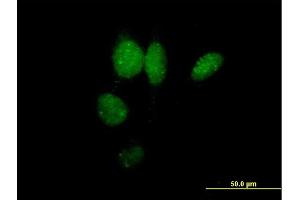 Immunofluorescence of purified MaxPab antibody to IRF2 on HeLa cell.