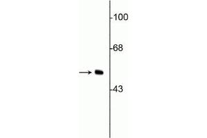 Western blot of HeLa cell lysate showing specific immunolabeling of the ~50 kDa vimentin protein. (Vimentin 抗体)