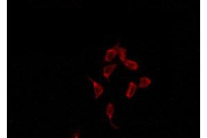 ABIN6274429 staining HepG2 by IF/ICC. (ACRBP 抗体  (Internal Region))