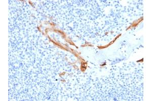 Formalin-fixed, paraffin-embedded human Tonsil stained with Cytokeratin 16 Mouse Monoclonal Antibody (SPM264). (KRT16 抗体  (C-Term))