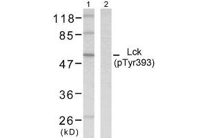 Western blot analysis of extracts from MOLT cells using Lck (phospho-Tyr393) antibody (E011144). (LCK 抗体  (pTyr393))