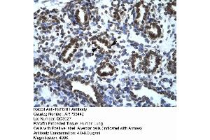 Human Lung (TGFB1I1 抗体  (Middle Region))