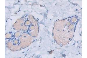 Detection of HSPb6 in Rat Skin Tissue using Monoclonal Antibody to Heat Shock Protein Beta 6 (HSPb6) (HSPB6 抗体  (AA 1-162))
