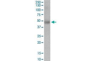 Western Blotting (WB) image for anti-Excision Repair Cross-Complementing Rodent Repair Deficiency, Complementation Group 6-Like (ERCC6L) (AA 1-419) antibody (ABIN527206)