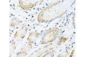 Immunohistochemistry (Paraffin-embedded Sections) (IHC (p)) image for anti-Sulfotransferase Family, Cytosolic, 2A, Dehydroepiandrosterone (DHEA)-Preferring, Member 1 (SULT2A1) antibody (ABIN7008595)