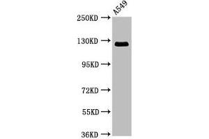Western Blot Positive WB detected in: A549 whole cell lysate All lanes: RANBP17 antibody at 3. (RANBP17 抗体  (AA 465-587))