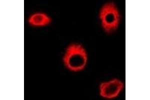 Immunofluorescent analysis of HAGH staining in A549 cells. (HAGH 抗体)