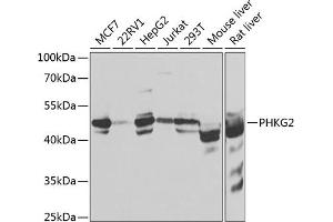 Western blot analysis of extracts of various cell lines, using PHKG2 antibody  at 1:1000 dilution. (PHKG2 抗体  (AA 237-406))