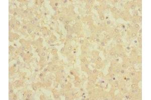 Immunohistochemistry of paraffin-embedded human liver tissue using ABIN7149302 at dilution of 1:100 (CRLF2 抗体  (AA 23-231))