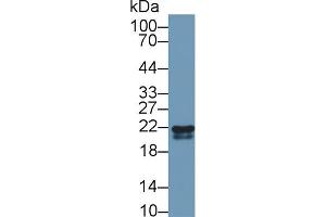 Western blot analysis of Cow Kidney lysate, using Rabbit Anti-Cow RBP4 Antibody (1 µg/ml) and HRP-conjugated Goat Anti-Rabbit antibody (abx400043, 0. (RBP4 抗体  (AA 19-201))
