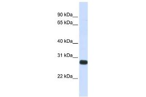 SPINT2 antibody used at 1 ug/ml to detect target protein. (SPINT2 抗体  (Middle Region))