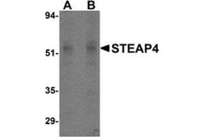 Western blot analysis of STEAP4 in rat liver tissue lysate with STEAP4 antibody at (A) 0. (STEAP4 抗体  (Center))