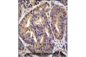 Immunohistochemistry (Paraffin-embedded Sections) (IHC (p)) image for anti-General Transcription Factor IIH, Polypeptide 2C (GTF2H2C) (AA 314-343), (C-Term) antibody (ABIN655372)