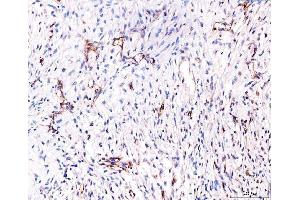 IHC analysis of CD93 using anti-CD93 antibody (ABIN7602865).