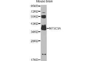 Western blot analysis of extracts of mouse brain, using NT5C3A antibody (ABIN6294220) at 1:1000 dilution. (NT5C3 抗体)