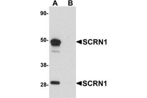 Western blot analysis of SCRN1 in human kidney tissue lysate with SCRN1 antibody at 1 μg/ml in (A) the absence and (B) the presence of blocking peptide. (Secernin 1 抗体  (C-Term))