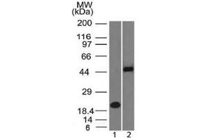 Western blot testing of 1) human partial recombinant protein and 2) human Raji cell lysate with PAX8 antibody (clone PAX8/1492). (PAX8 抗体  (AA 60-261))