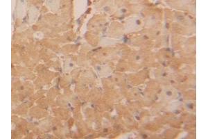Detection of LDHB in Rat Heart Tissue using Polyclonal Antibody to Lactate Dehydrogenase B (LDHB) (LDHB 抗体  (AA 1-334))