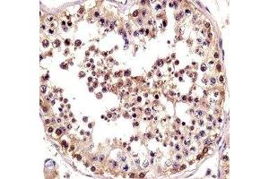 TSPY antibody immunohistochemistry analysis in formalin fixed and paraffin embedded human testis tissue. (TSPY1 抗体  (AA 274-303))