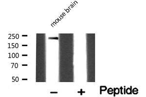 Western blot analysis of Dysferlin expression in Mouse brain lysate (Dysferlin 抗体  (C-Term))